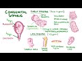 Syphilis | Clinical Presentation