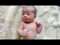 Bald newborn baby is so cute just after birth #bald #cute #viral #baby