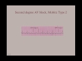 Cardiology Review Questions - CRASH! Medical Review Series