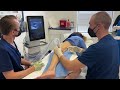 Foot Drop Treatment with Fibular Nerve Hydrodissection