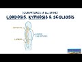 Curvatures of the Spine- Lordosis, Kyphosis & Scoliosis