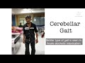 Cerebellar Ataxia #Gait #Abnormal #TandemWalk  #neurology #widebasegait #tandemgait #meded