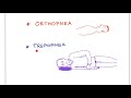 Platypnea-Orthodeoxia Syndrome