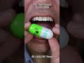 Doctor Tristan Peh's Best ASMR Chewing Moments Await You