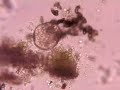 lichen organism