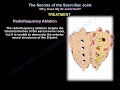 sacroiliac Joint  pain why it Hurts - Everything You Need To Know - Dr. Nabil Ebraheim
