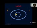 Fetal Echocardiography Basics [Ultrasound] | Dr. Anirudh Badade