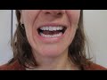 5 Minute Tongue Exercises for Speech and Swallowing