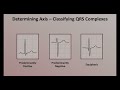 Intro to EKG Interpretation - Rate and Axis