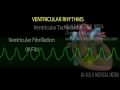 Cardiac Arrhythmias, Animation