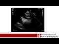 Level 1 Video Lecture: Ultrasound Physics