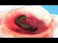 What If a Leech Is Given The Blood Of a Drug Addict To Drink?