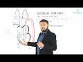 Ventricular Septal Defect : Etiology, Pathophysiology, Clinical features, Diagnostics, Treatment