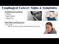 Esophageal Cancer | Risk Factors, Pathogenesis, Signs and Symptoms, Diagnosis, Treatment