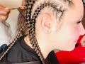 How to Make Cornrows/Braids on a White Person’s Hair