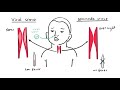 What is Croup (larynotracheobronchitis) - symptoms, pathophysiology, investigations, treatment