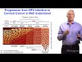 John Schiller (NCI at NIH) 1: Human Papillomavirus (HPV) Vaccines to Prevent Cancer