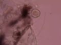 round organism in lichen sample 2