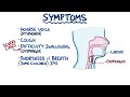 Laryngitis - causes, symptoms, diagnosis, treatment, pathology