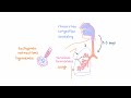 Respiratory Syncytial Virus (RSV) - Clinical Presentation