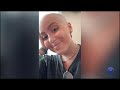 Learning I had Stage 4 Cancer at 19 - Erin | Non-Hodgkin Lymphoma | The Patient Story