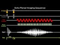 Echo Planar Imaging (EPI) EXPLAINED | MRI Physics Course Lecture 13