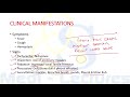 PNEUMONIA | Etiology | Clinical Features | Diagnosis | Treatment | Harrison