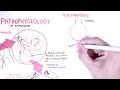 Emphysema - Pathophysiology (COPD)
