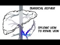 Portal Hypertension: Animated Review