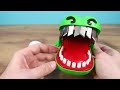 Test out the dentist's new Crocodile teeth!