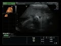 Sapphire's 3D UltraSound foe Zoei (June 16th, 2024)