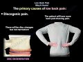 Low Back Pain Why It Hurts - Everything You Need To Know - Dr. Nabil Ebraheim