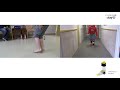 Before and After | Strong toe walking | DAFO Tami2