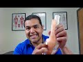 🔴 LIVE - Get Expert Answers For Meniscus Injuries From Dr. David