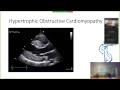 Congenital Arrhythmogenic Pathologies - An Overview with Dr. Chris Reed