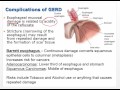 Chapter29 Video   Disorders of GI function