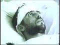 Footage from 1955 shows man falling ill with rabies after being bitten by a wolf.