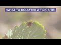 While You are Social Distancing, Ticks Are Not - Tips on Protecting Yourself from Lyme Disease