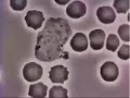 White blood cell killing bacteria