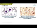 Bordetella Pertussis Animation | Microbiology USMLE Step 1