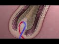 Androgenic Alopecia Treatment with Rogaine Animation