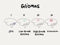 Doctor Explains Glioma Brain Tumor