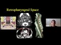 Head & Neck Spaces Made Simple, Dr. Suresh Mukherji - MRI Online Noon Conference