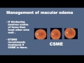 diabetes retinopathy demystified