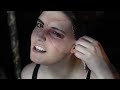 Burn Scars: SFX makeup tutorial