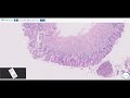 Normal Histology of Esophagus and Stomach | Pathology 101| GI Pathology