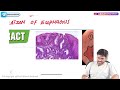 6. Barrett's Esophagus : USMLE Step 1 Pathology