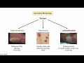 Introduction to Dermatology | The Basics | Describing Skin Lesions (Primary & Secondary Morphology)