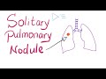 Solitary Pulmonary Nodule (SPN): How to manage it!