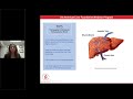 Progression of Liver Disease Webcast Series: Cirrhosis and Signs of Liver Failure